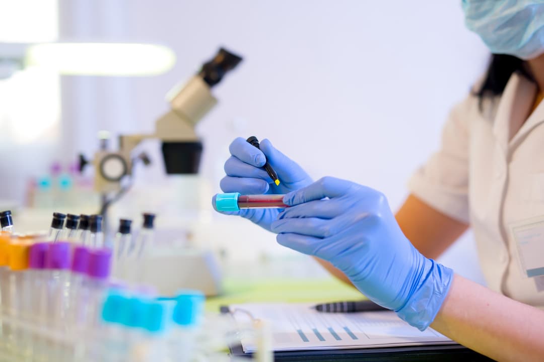 Woman working in a laboratory, writing with a felt pen
