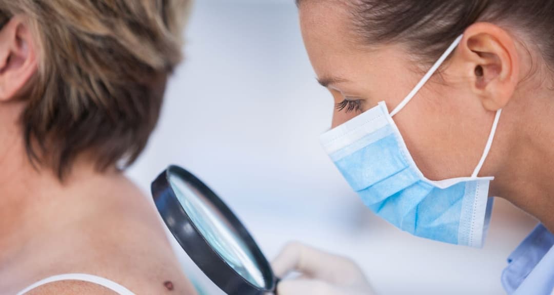 Does Insurance Cover Dermatology