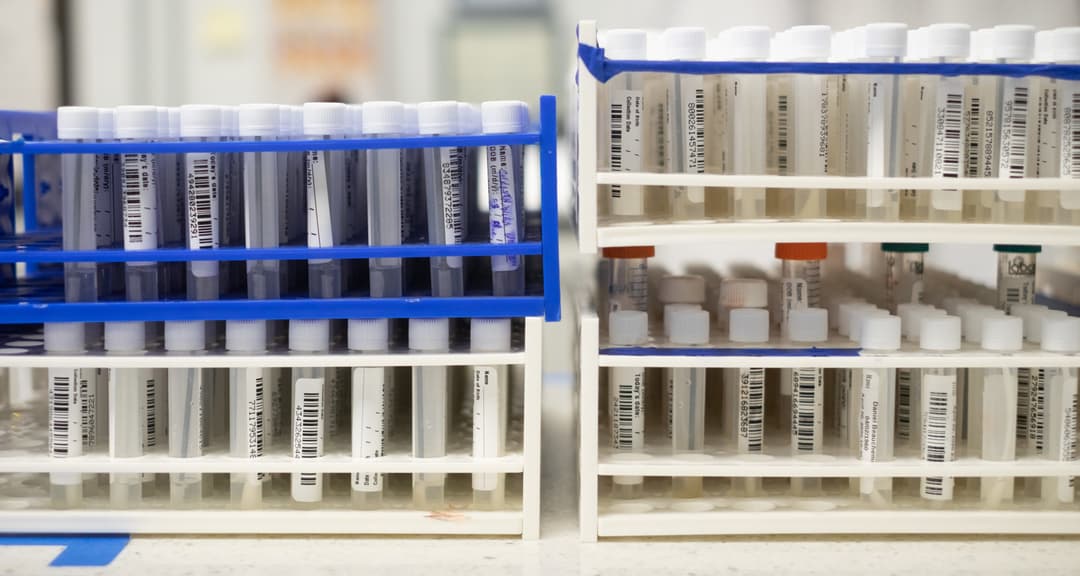COVID-19 Causes, Symptoms, Treatment and Prevention