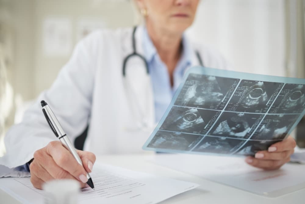 Shot of a doctor analysing ultrasound scans